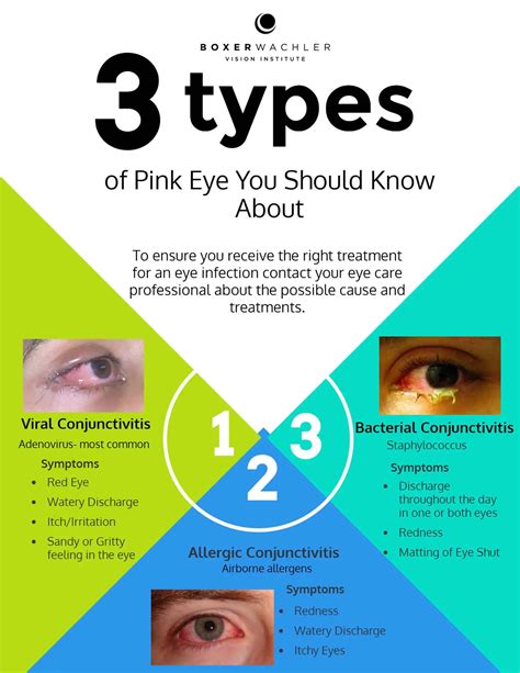 Pink Eye Is A Common Eye Condition Remember To Wash Your Hands