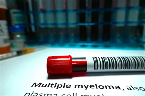 Neues Wirkprinzip Beim Multiplen Myelom