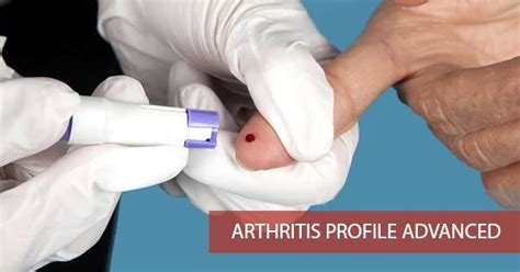 Thyrocare Arthritis Profile Advanced 67 Tests Rs 3070