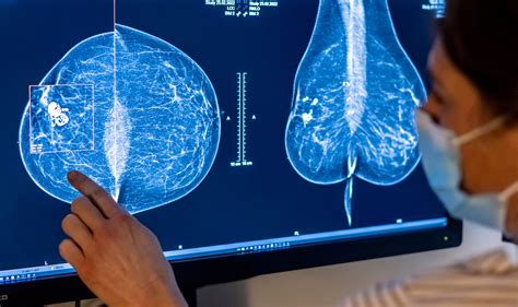 Fda Announces New Mammogram Standards For People With Dense Breasts