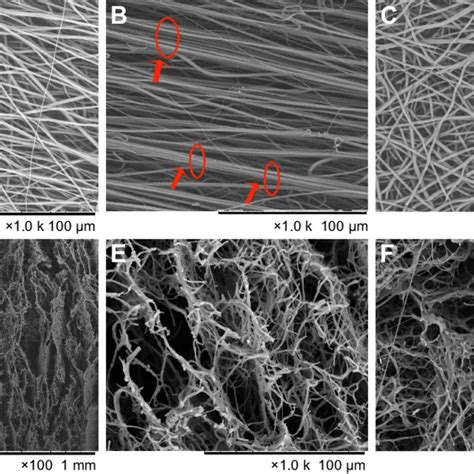 (PDF) A novel electrospun-aligned nanoyarn/three-dimensional porous ... 