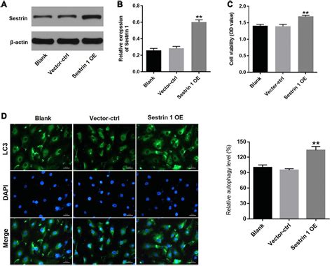 Inhibition Of Sestrin 1 Alleviates Polycystic Ovary Syndrome By