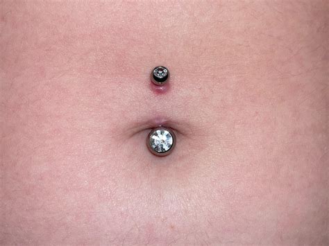 Got My Belly Button Pierced 5 Days Ago Is This A Regular Irritation