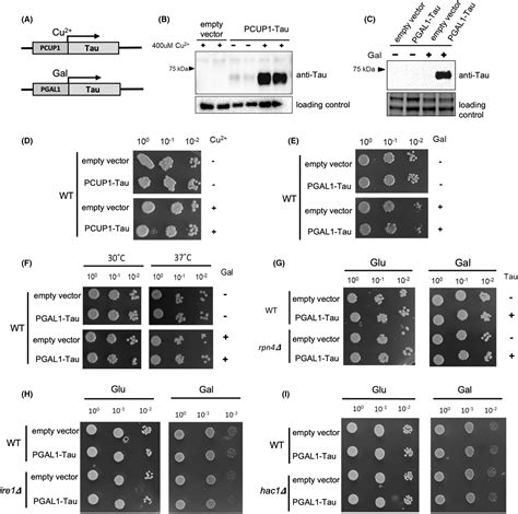 Effects Of Heterologous Human Tau Protein Expression In Yeast Models Of