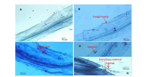 Root Colonization By Arbuscular Mycorrhizal Fungi Funneliformis