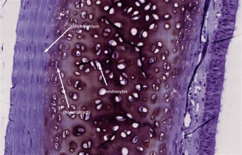 Msk Histology Of Bone Flashcards Quizlet