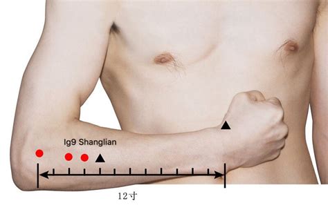 Ig Shanglian Punto Acupuntura Del Meridiano Del Intestino Grueso