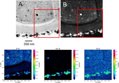 Scanning Transmission Electron Microscopy STEM Views Of Extracellular