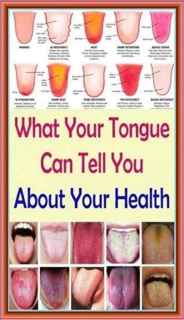 7 Things Your Tongue Is Trying To Tell You About Your Health Tongue Health Health Tips Health