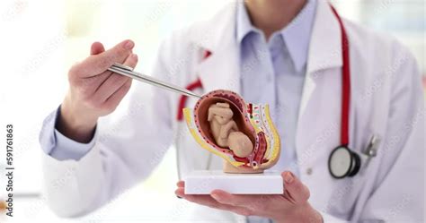 Doctor With Stethoscope Points Pen To Realistic Model Of Uterus With