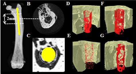 Qualitative Micro Ct Analysis Of Fgf Stimulated Peri Implant Bone