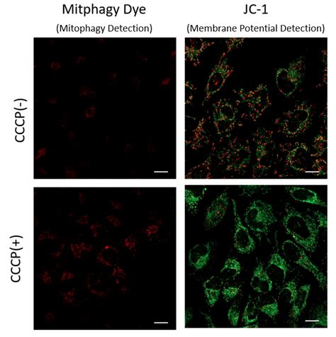 Mitochondrial Membrane Potential Detection Jc 1 Mitomp Detection Kit