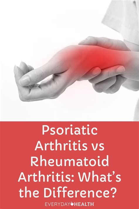 Psoriatic Arthritis Vs Rheumatoid Arthritis Artofit