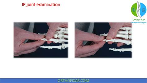 Wrist Hand Examination Easy Tutorial OrthoFixar 2024