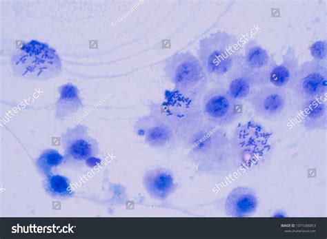 Human Chromosomes Under Microscope View Education Stock Photo 1071088853 | Shutterstock