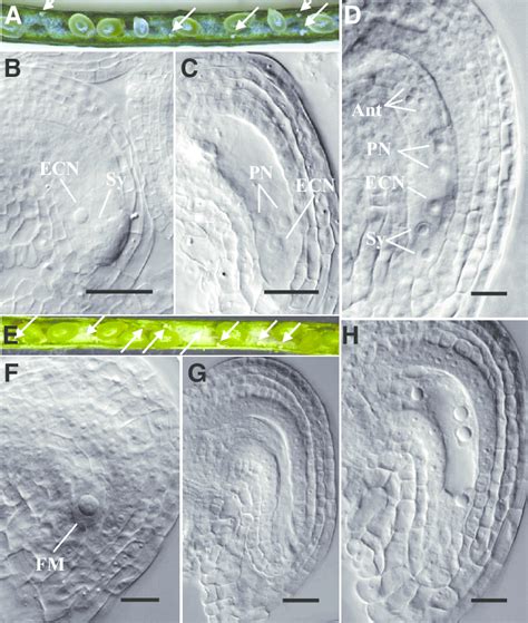 Embryo Sac And Seed Set Phenotypes Of The Mitotic Class Mutants Kupalo