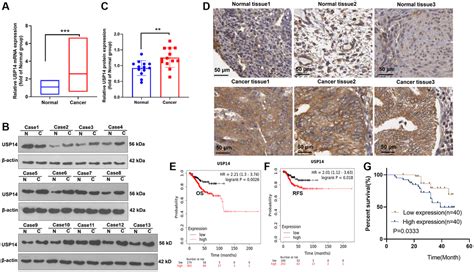 Usp Predicts Poorer Survival Outcomes And Promotes Tumor Progression