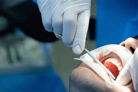 Curetaje dental Qué es Tratamientos y Contraindicaciones