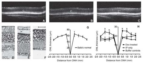 OCT images, brightfield micrographs, and ONL thickness quantification ...