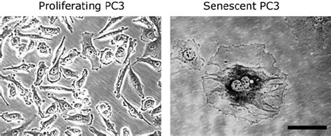 Proliferating And Drug Induced Senescent Pc3 Prostate Cancer Cells