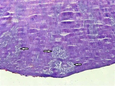 Tissue detritus (from tonsillar crypts). Arrows indicate bacterial ...