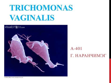 Trichomonas Vaginalis