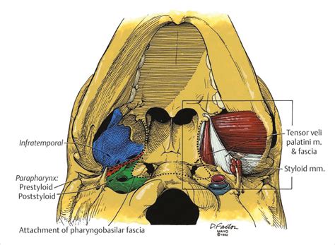 20 Tumors Of The Parapharyngeal Space Neupsy Key