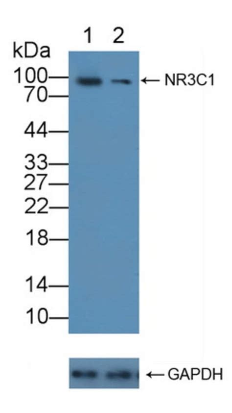 Glucocorticoid Receptor Polyclonal Antibody Invitrogen L