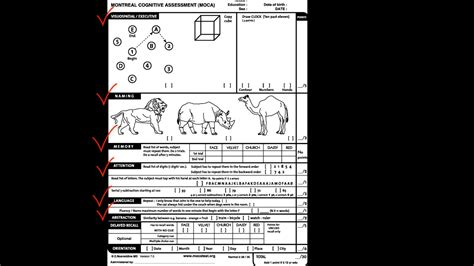 Montreal Cognitive Assessment Form Moca Youtube