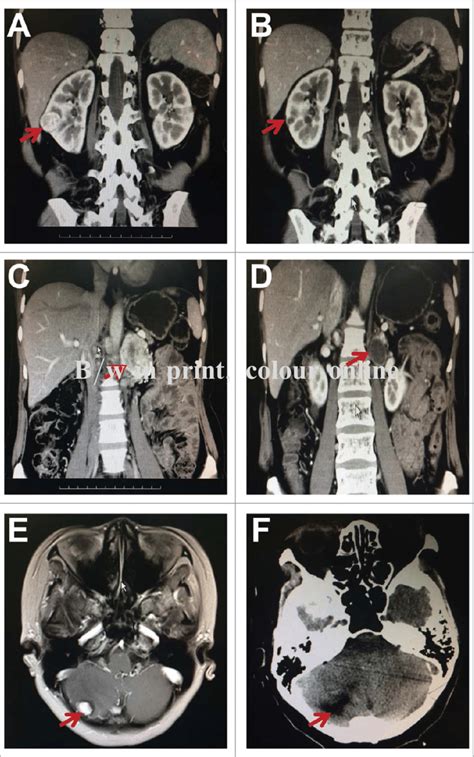 Computed Tomography Ct And Magnetic Resonance Imaging Mri Scans