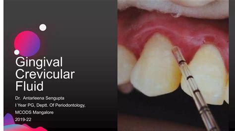 Gingival Crevicular Fluid Ppt