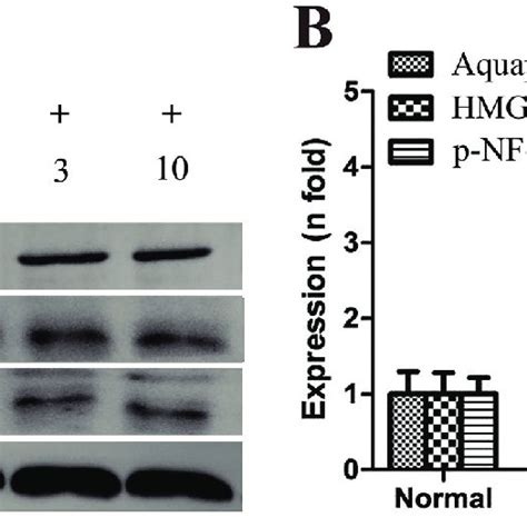 Influence Of Saquinavir Sqv On High Mobility Group Box Hmgb