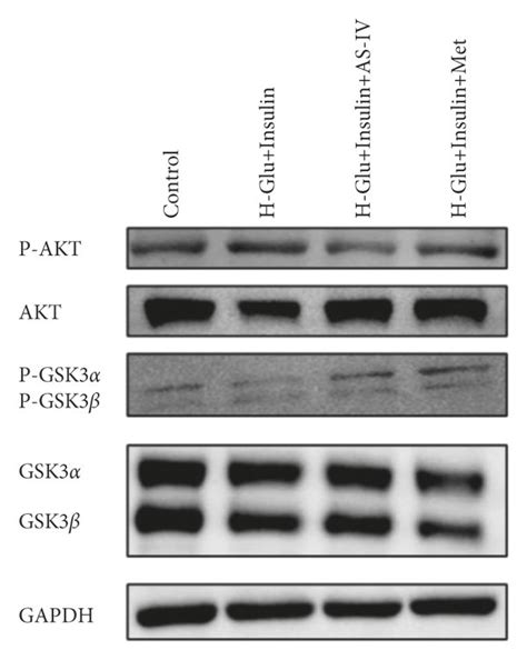 Aktgsk3αβ Signaling Pathway Evaluation A Expression Of P Akt Akt