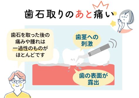 歯石取りは痛い？痛みの原因と対策、歯石除去の重要性を解説 野田阪神アルプス歯科【公式】野田阪神・海老江・福島区の歯医者さん