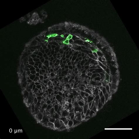 Distinct Mesoderm Migration Phenotypes In Extra Embryonic And Embryonic