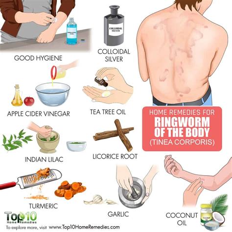 Pin On Disease