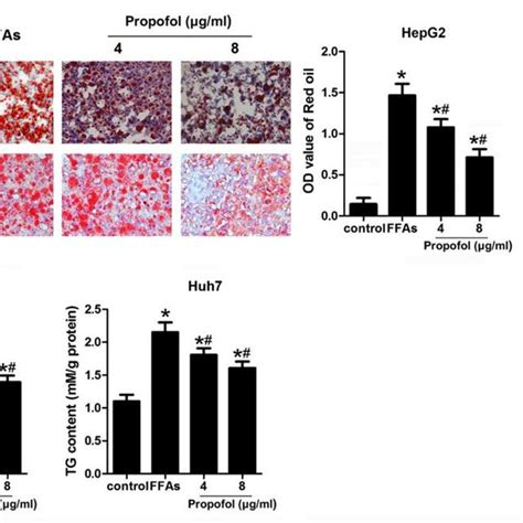 Medium And Long Chain Triglyceride Mctlct Propofol Reversed Free