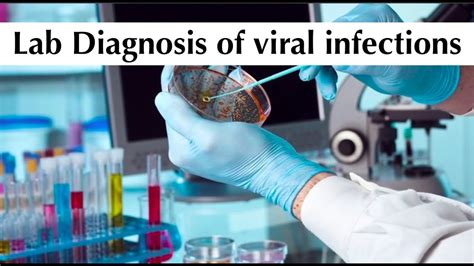 Microbiology 6th Practical Tuotorial Lab Diagnosis Of Viral Infections