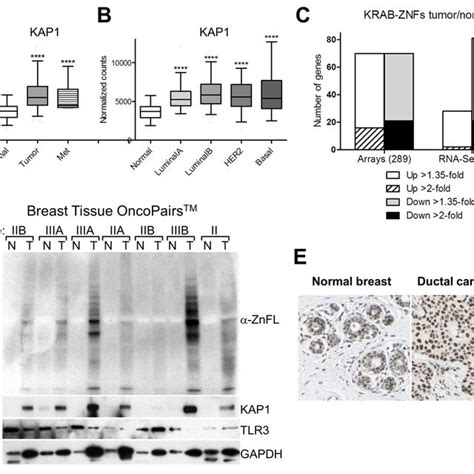 KAP1 MRNA Protein And SUMOylation Are Up Regulated In Breast Cancer