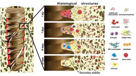 Osseointegration in Dental Implant: Definition, Benefits & Processes