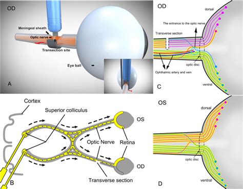 Schematic Diagram Of RGC Labeling On The Retina After Partial