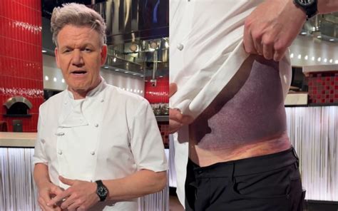 Gordon Ramsay Urges Cyclists To Wear Helmets After Nasty Accident Rnz