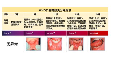 口腔溃疡疼痛难忍怎么办这些小妙招帮你快速赶走口腔麻烦精 医院汇 丁香园