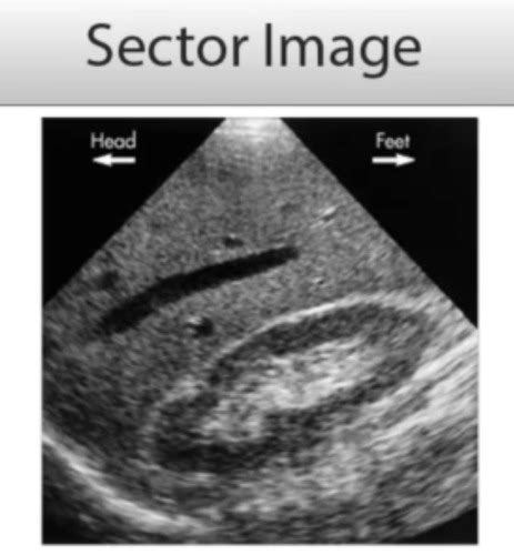 Ultrasound Physics Week Session Flashcards Quizlet