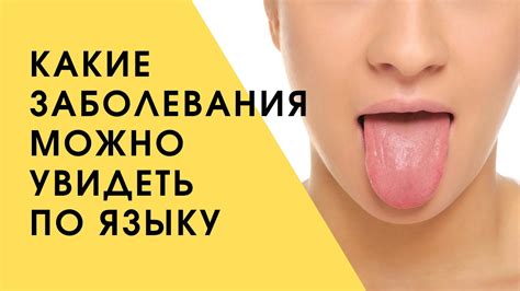 Диагностика по языку | Почему на языке появилась болячка - YouTube