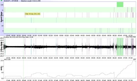 what does it mean if my AHI only gets particularly bad during my last couple of hours of sleep ...