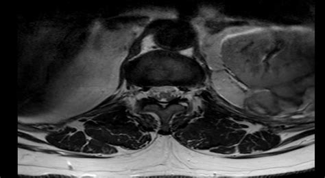 Contrast Enhanced Axial Sections Download Scientific Diagram