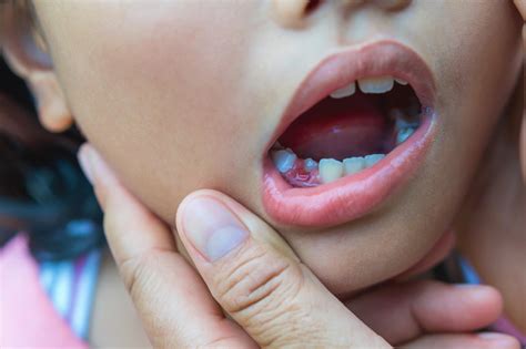 Losing Baby Teeth Chart Everything You Need To Know About Baby Teeth