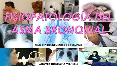 Fisiopatologia Del Asma Asma Bronquial Udocz The Best Porn Website