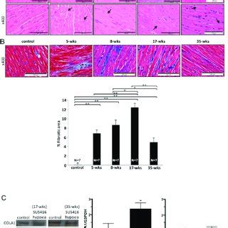 Rv Damage And Fibrosis Su Injected Rats Were Subjected To Weeks